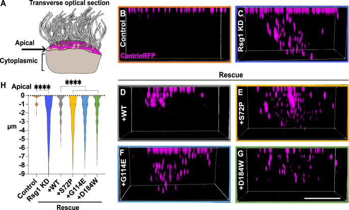 Fig. 4: Ciliopathy-associated alleles of RSG1 disrupt basal body docking.