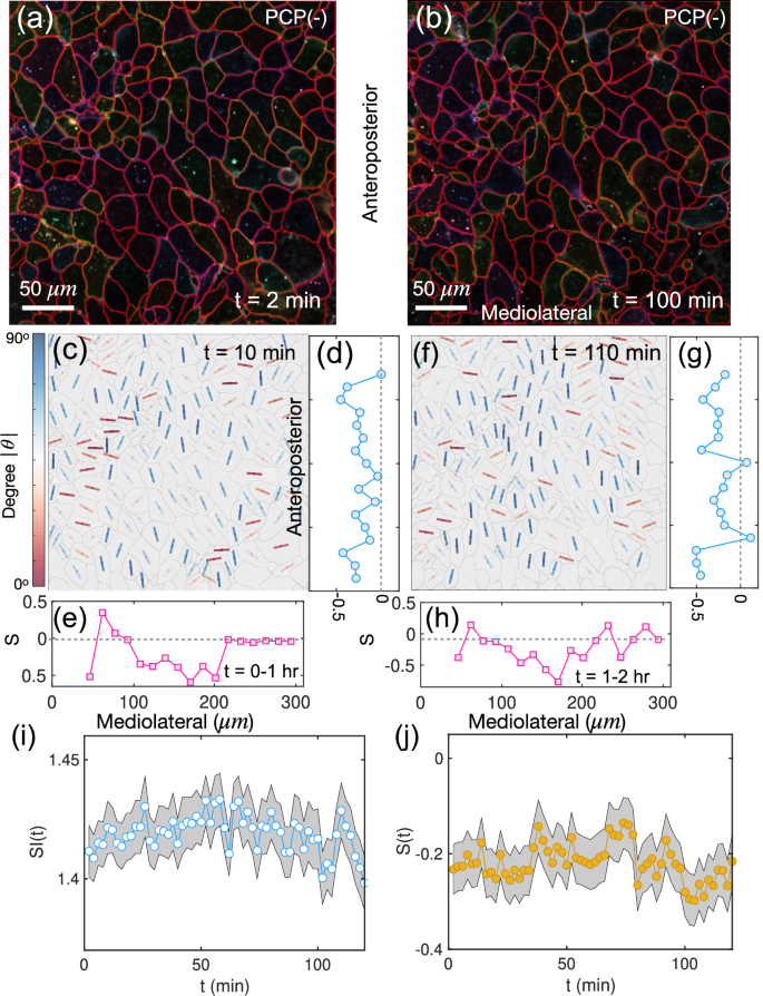 Fig. 5: Reduced nematic order in PCP mutant Xenopus.