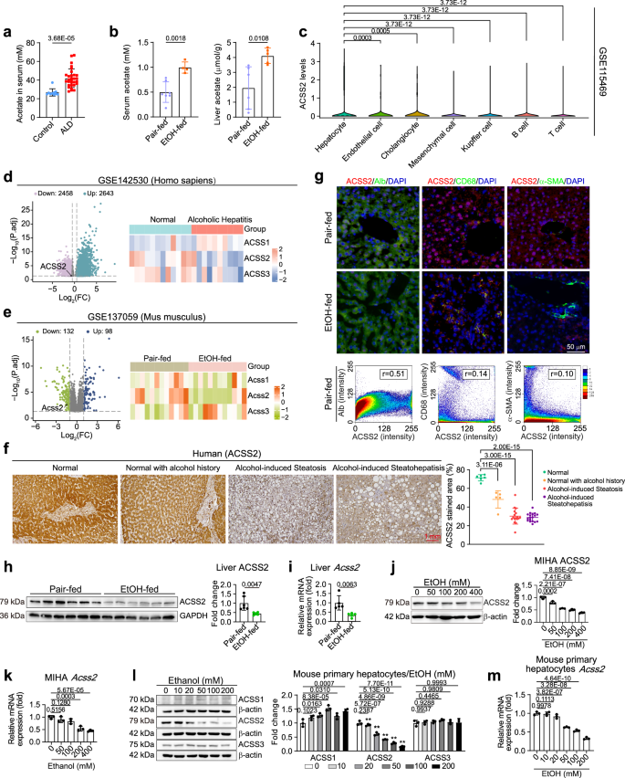 Fig. 1: ACSS2 is downregulated in ALD models.