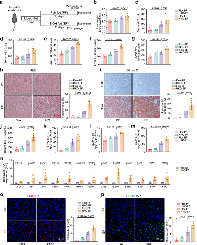 Fig. 2: Hepatocyte-specific ACSS2 deficiency exacerbates alcohol-induced liver injury and inflammation.