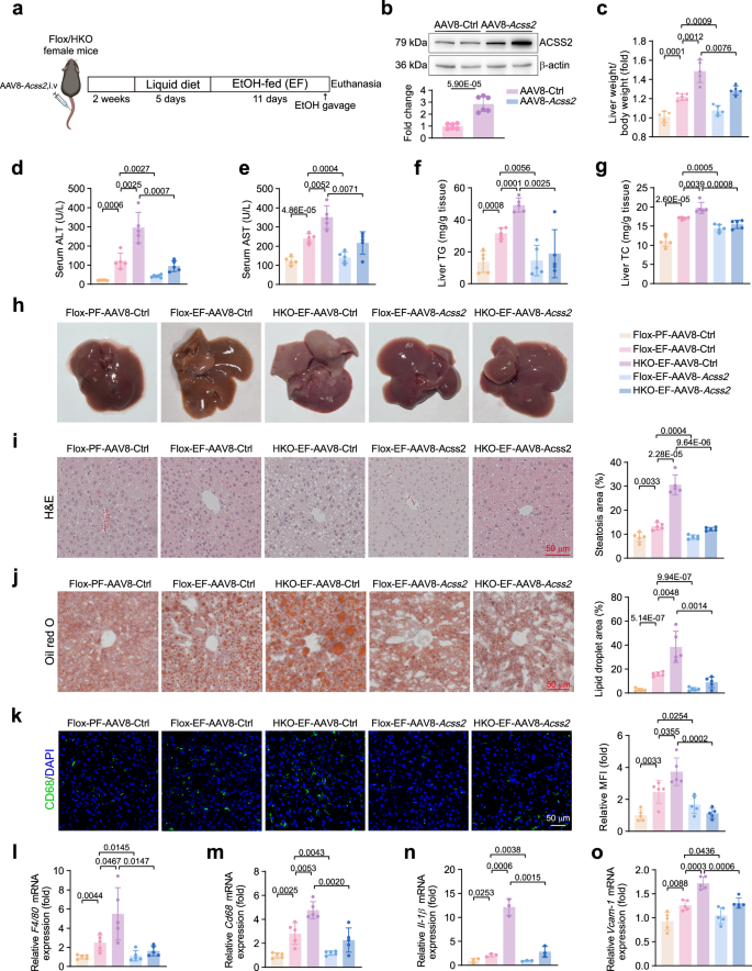Fig. 5: ACSS2 overexpression in hepatocytes decreases alcohol-induced liver injury and inflammation in mice.