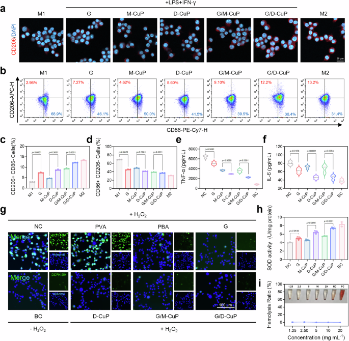 Fig. 4: In vitro anti-inflammatory effects and antioxidant capacity of the G/D-CuP.