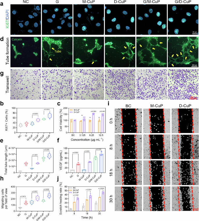 Fig. 5: In vitro promotion of cell proliferation, migration, and angiogenesis effects of the G/D-CuP.