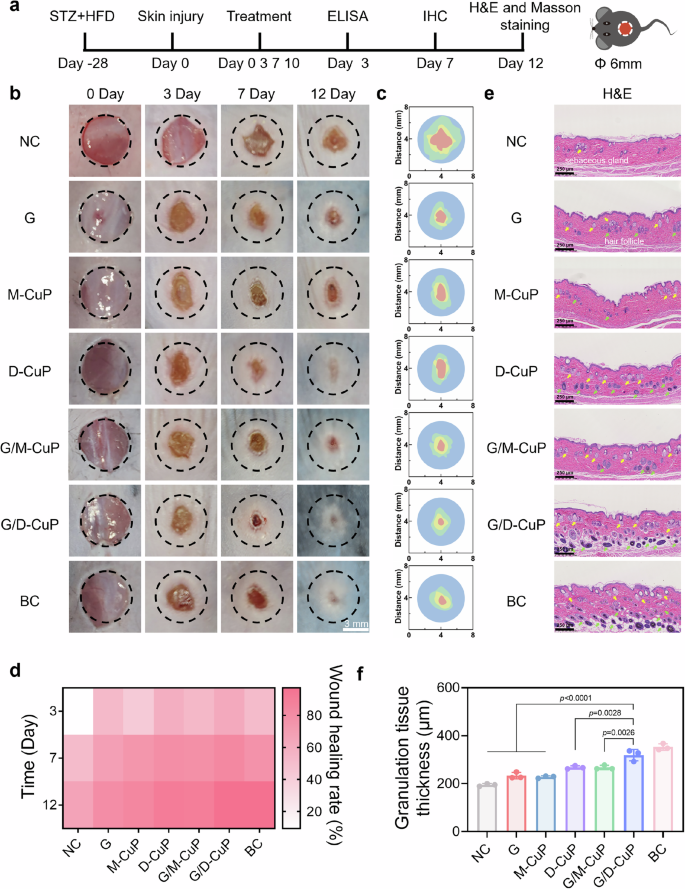 Fig. 7: Effects of the G/D-CuP in promoting diabetic wound healing.