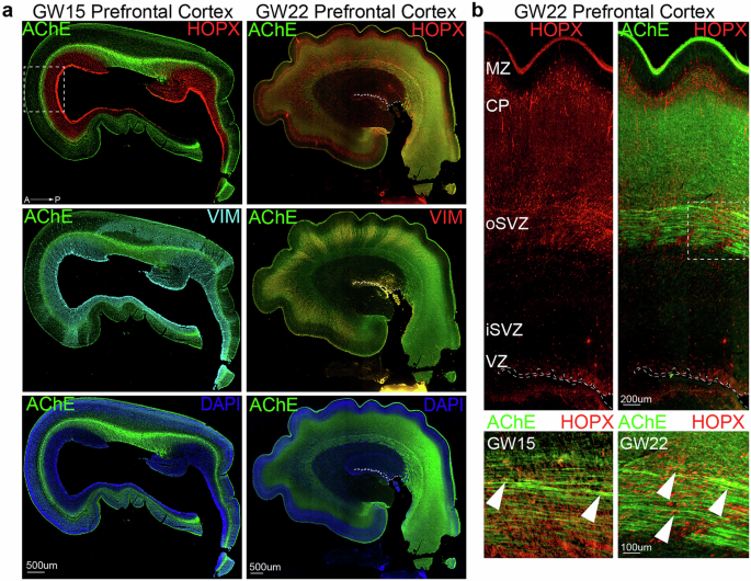 Fig. 1: Acetylcholinesterase (AChE) is expressed in the developing prefrontal cortex throughout cortical development (GW15-22).