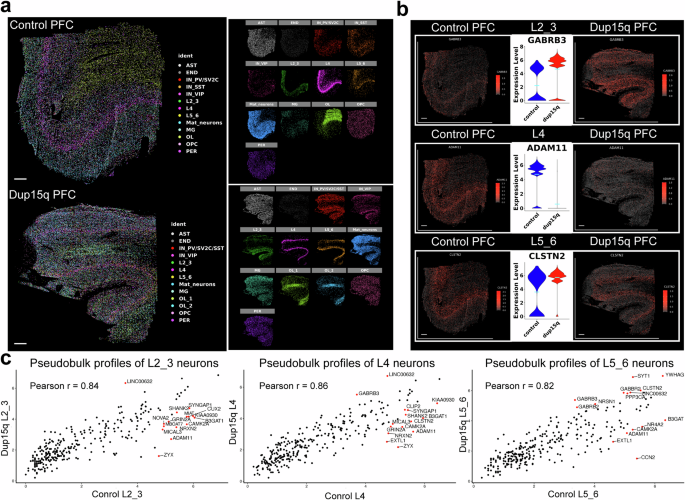 Fig. 3: Spatially resolved transcriptomics of the dup15q syndrome prefrontal cortex.