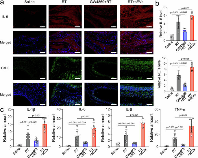 Fig. 2: Relative sEVs and dsDNA levels in the mouse model with RIM.