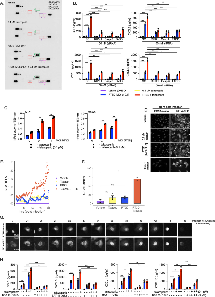 Fig. 5: NF-κB activity and pro-inflammatory cytokine production is enhanced following RT3D and talazoparib treatment.