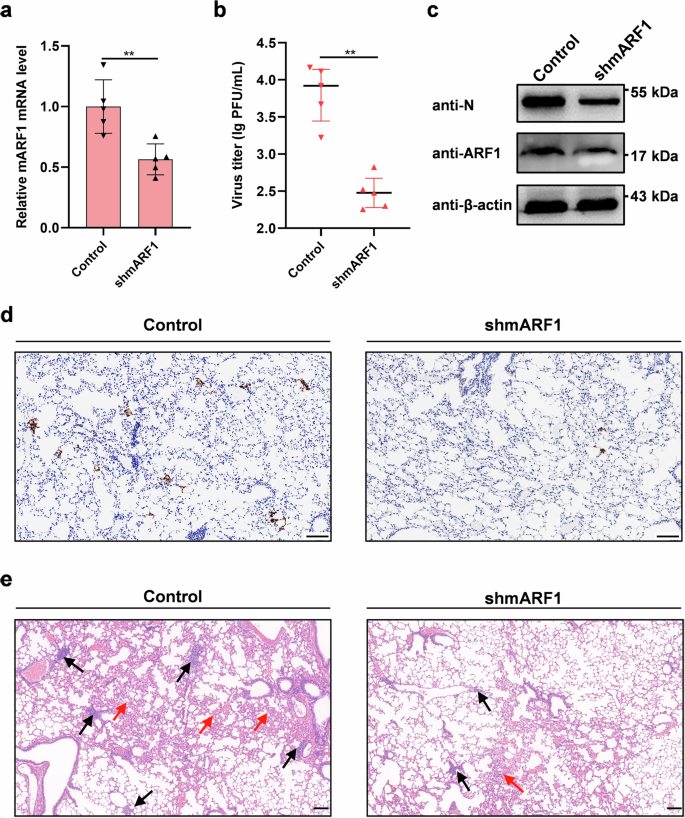 Fig. 3: The role of ARF1 in SARS-CoV-2 infection and pathogenicity in vivo.