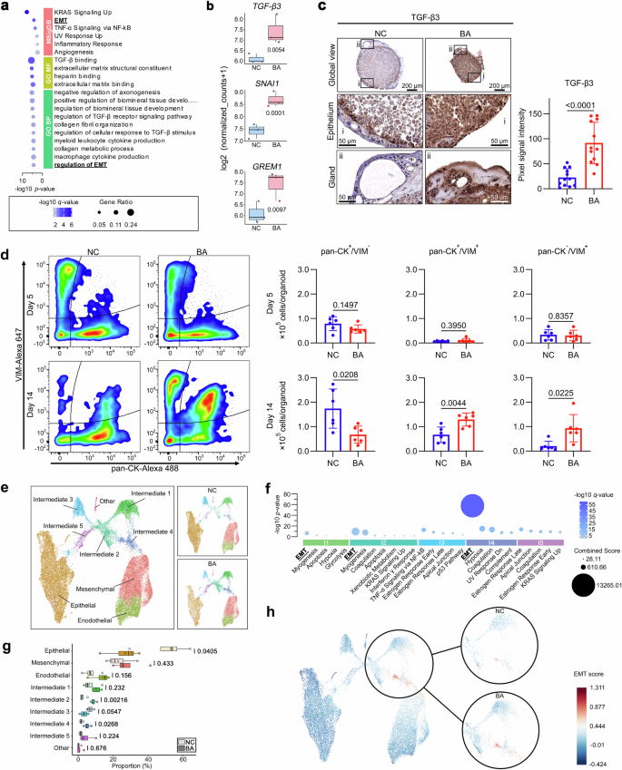 Fig. 3: Presence and cellular lineage of EMT in patient-derived organoids.