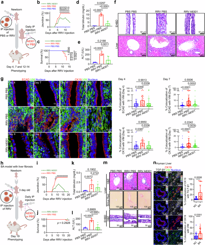 Fig. 6: Clinical relevance and therapeutic potential of TGF-β-induced EMT in BA.