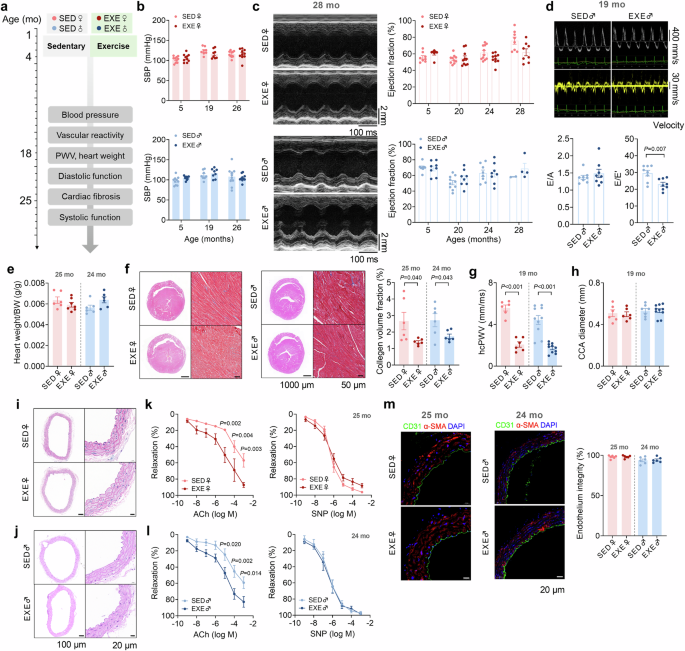 Fig. 3: Early-life exercise attenuates cardiovascular aging in aged mice.