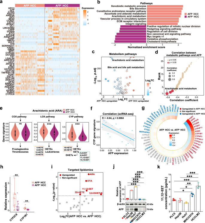 Fig. 2: Transcriptomic differences of tumor cells between AFP– HCC and AFP+ HCC.