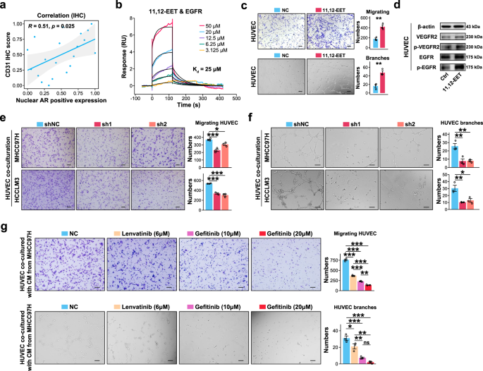 Fig. 5: Activation of EGFR with AR-induced 11,12-EET from AFP− HCC tumor cells promoted aberrant angiogenesis.