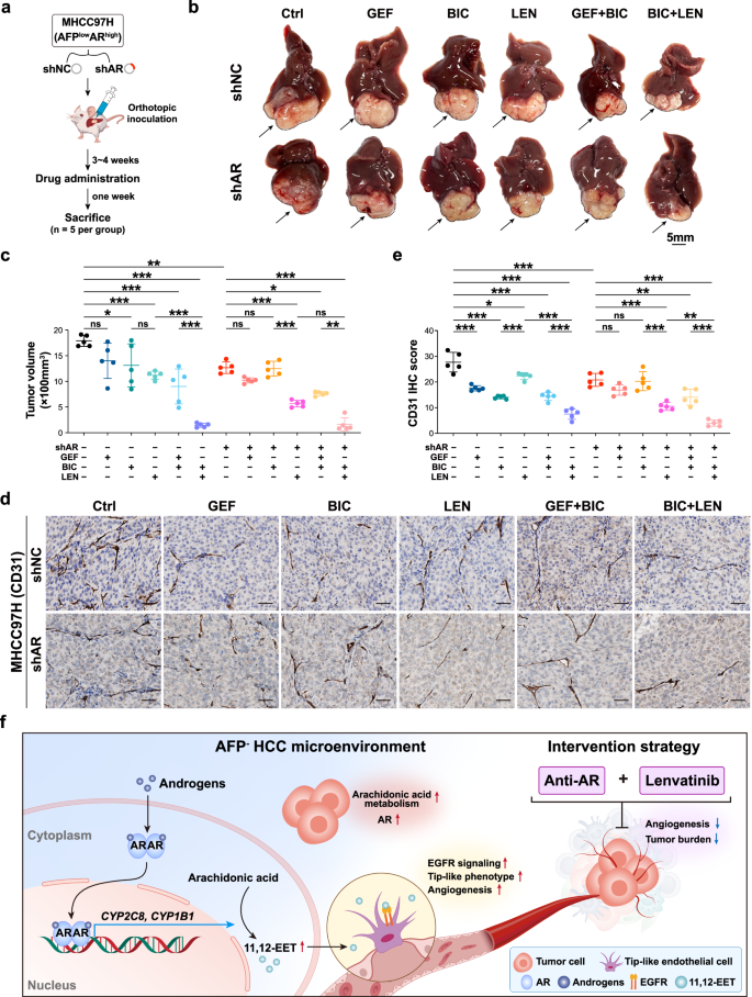 Fig. 7: Combined inhibition of AR-mediated anti-angiogenesis with lenvatinib repressed tumor progression in AFP− HCC in vivo.