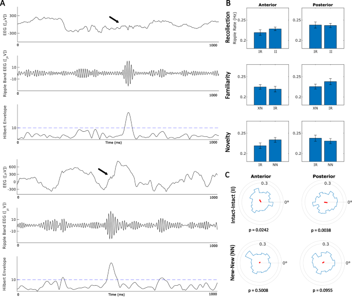 Fig. 6: Longitudinal differences in hippocampal ripples.