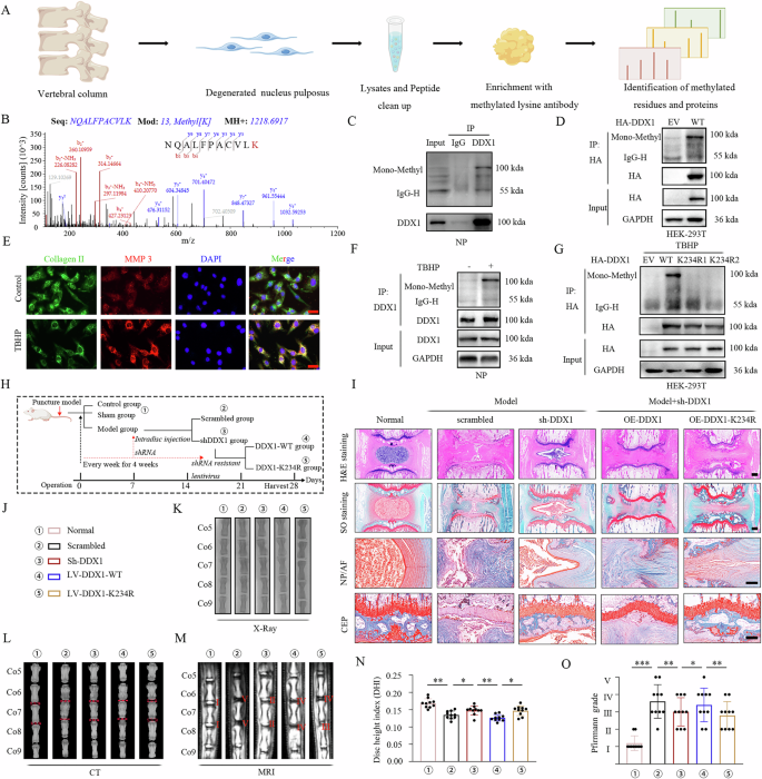 Fig. 1: Mono-methylation of DDX1 lysine 234 in NP cells during IVDD.