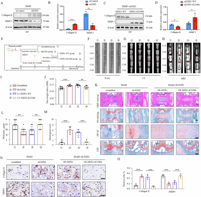 Fig. 3: Activation of the EZH2-dependent DDX1 methylation pathway promotes IVDD.