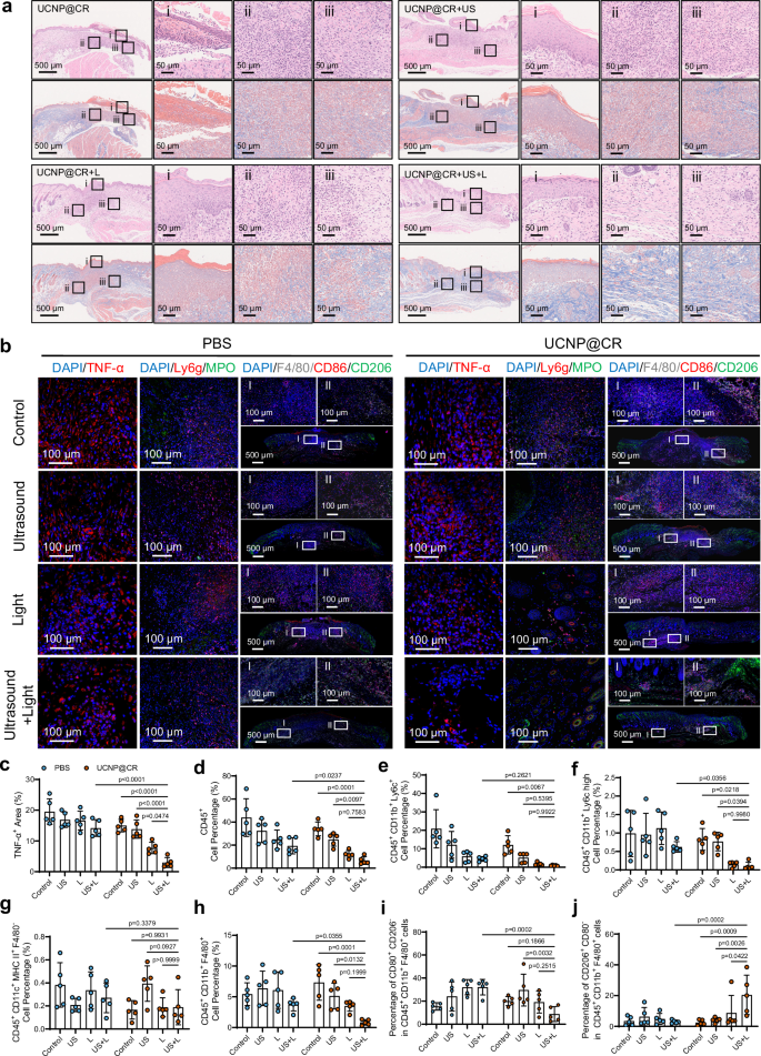 Fig. 8: Tissue regeneration assessment and inflammatory response of the biofilm infected wound after treatment.