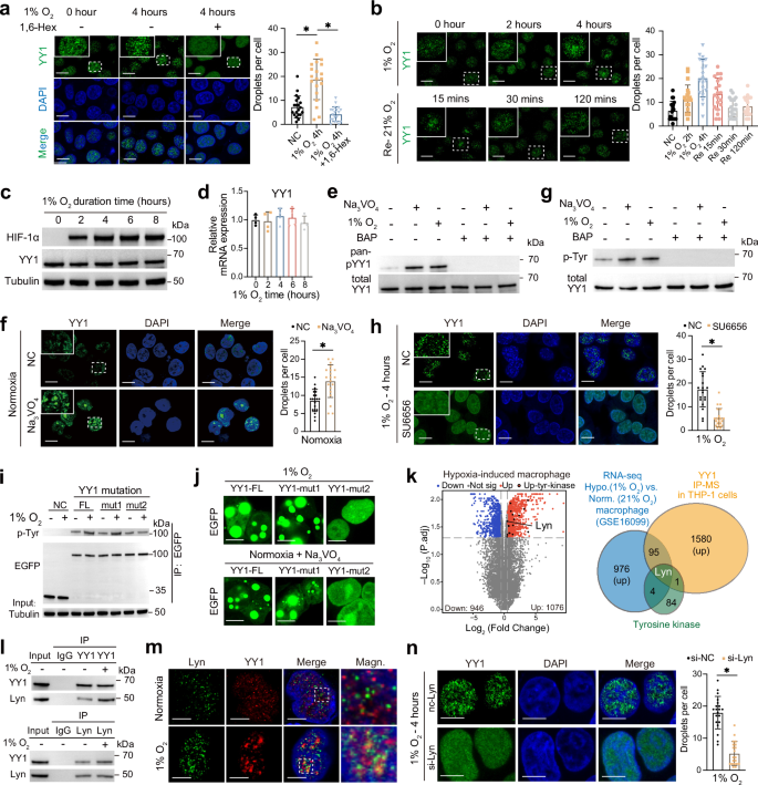 Fig. 2: Hypoxia enhances YY1 phase separation by inducing YY1 tyrosine phosphorylation in macrophages.