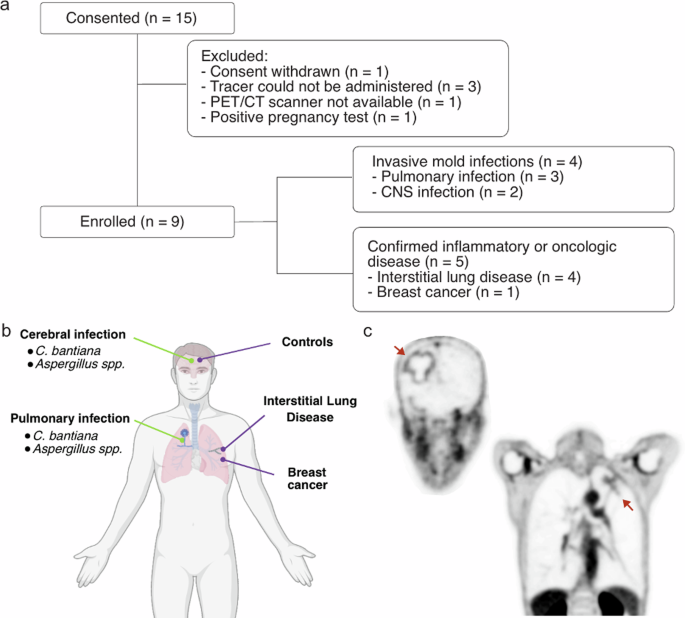 Fig. 1: Clinical study design.