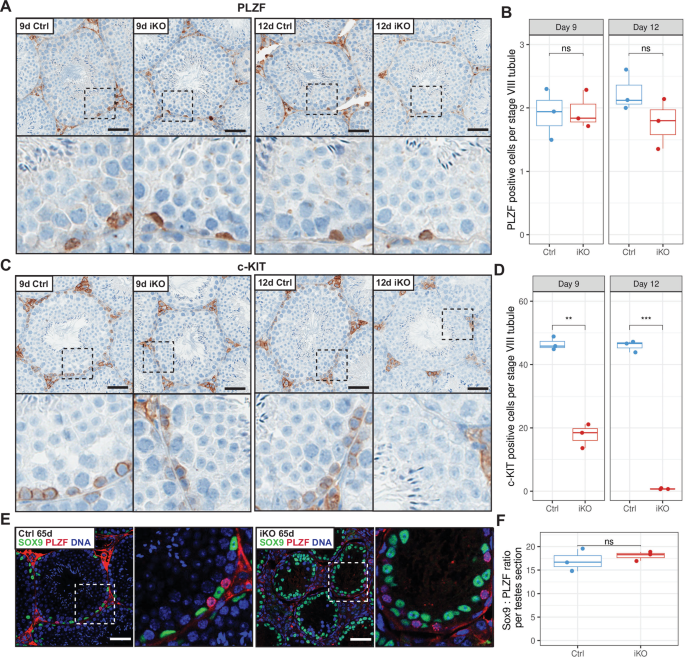 Fig. 3: Depletion of c-KIT + differentiating spermatogonia in Kdm2a iKO.