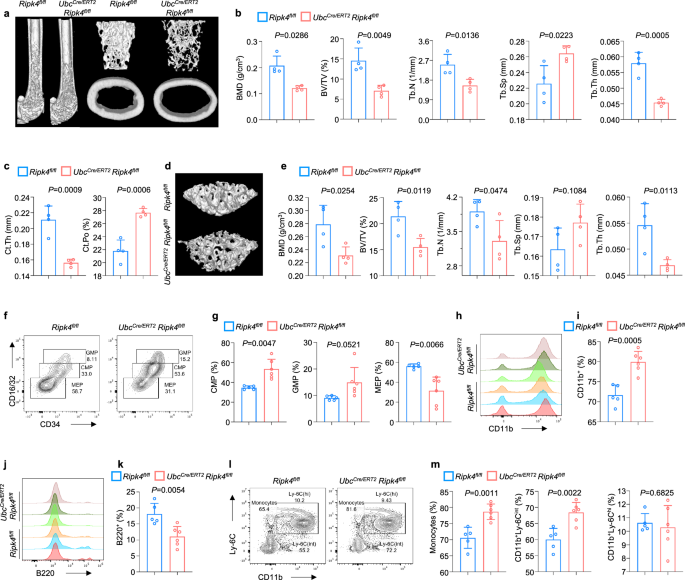 Fig. 1: Global RIPK4 deficiency in adult mice induces osteoporosis and myeloid-biased hematopoiesis.