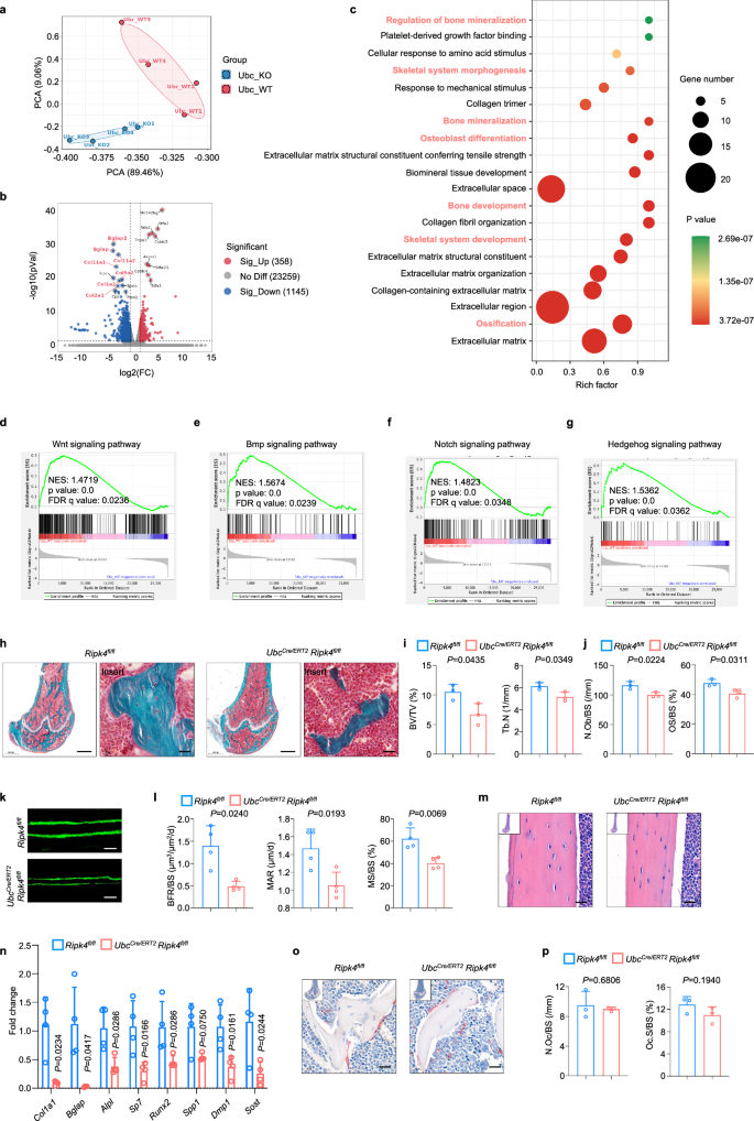 Fig. 2: Global RIPK4 deficiency in adult mice impairs bone formation.