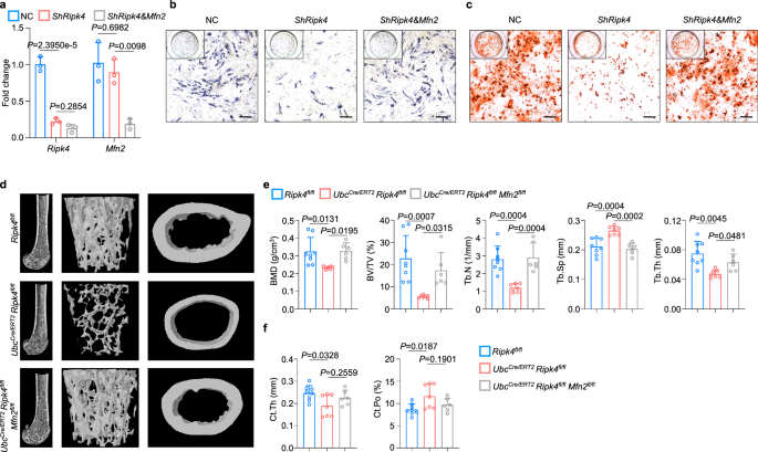 Fig. 6: RIPK4 regulates osteogenesis via MFN2.