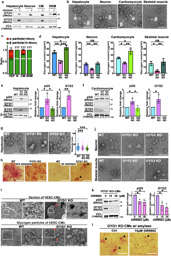 Fig. 7: An appropriate glycogen particle size distribution requires proper amounts of both GYG1 and GYG2 in different cell lineages.
