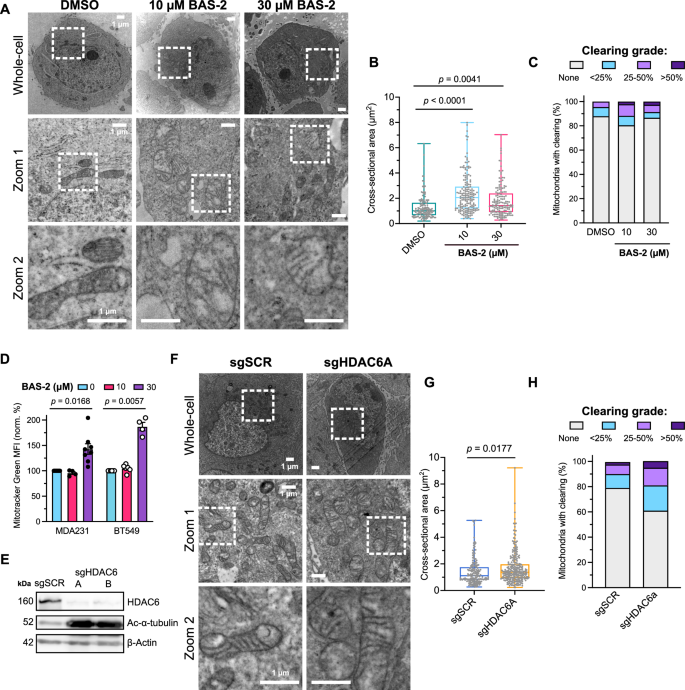 Fig. 1: Targeting HDAC6 activity in TNBC cells results in mitochondrial enlargement and cristae clearance.