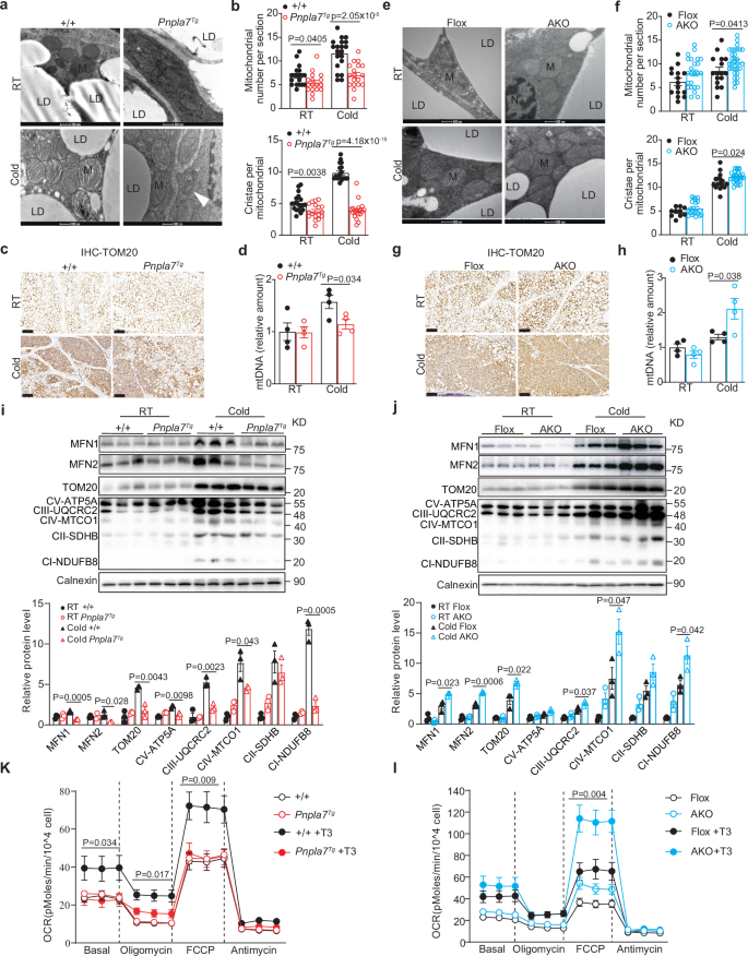 Fig. 3: PNPLA7 decreases mitochondrial content and mitochondrial oxidative respiration in the adipose tissue.