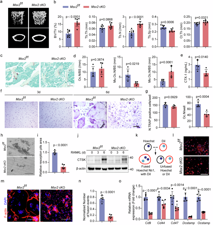 Fig. 1: Myeloid Msx2 deficiency improves bone mass through inhibiting pre-osteoclast fusion.
