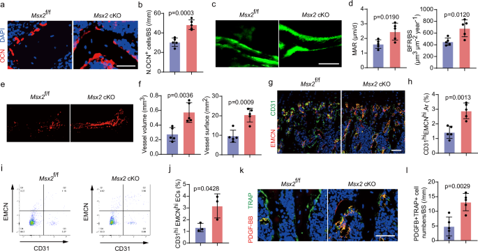 Fig. 2: Loss of Msx2 promotes bone formation and angiogenesis.