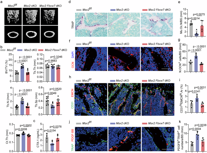 Fig. 5: Msx2 Fbxw7 double knockout blunts the bone protective effect of Msx2 deficiency.
