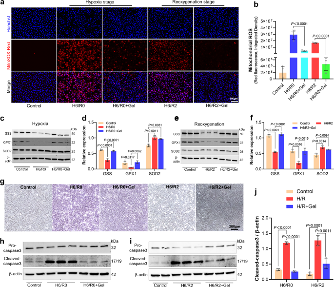 Fig. 3: GA hydrogel reduces H/R-induced ROS generation and cell death.
