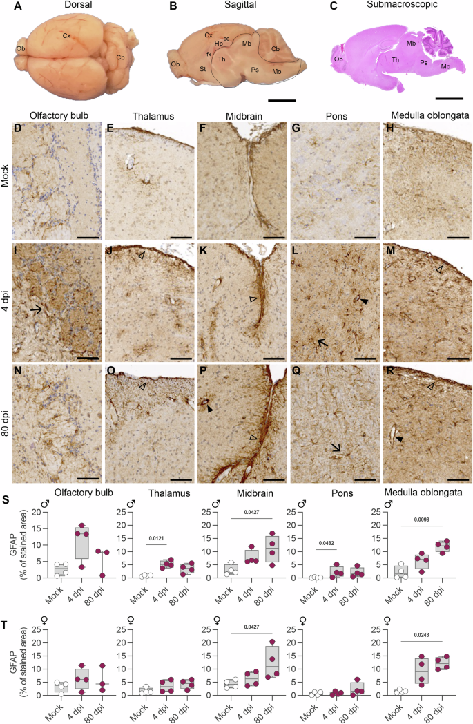 Fig. 2: Histopathological analysis in the brain of hamsters intranasally-inoculated with SARS-CoV-2 Wuhan.