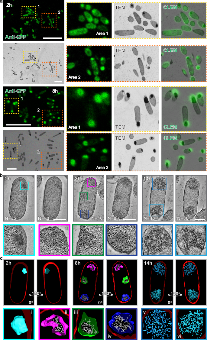 Fig. 5: Electron microscopy images showing that aged intracellular condensates accumulate protein aggregates and lose phase-separated barrier.