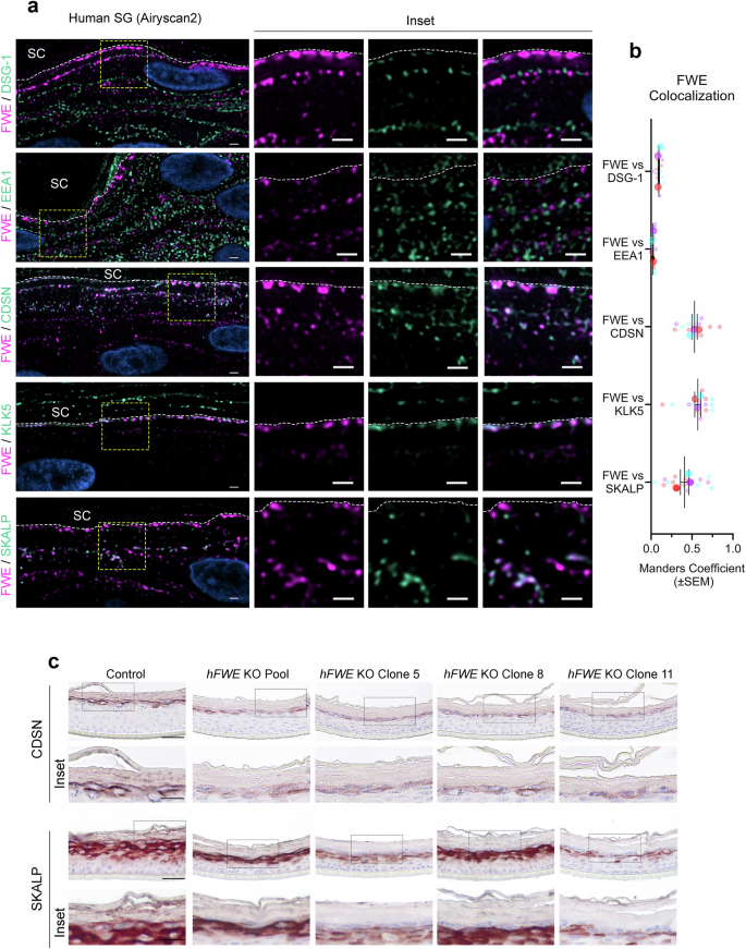 Fig. 3: Flower localizes to epidermal lamellar bodies (LBs) and facilitates their apically-directed secretion.