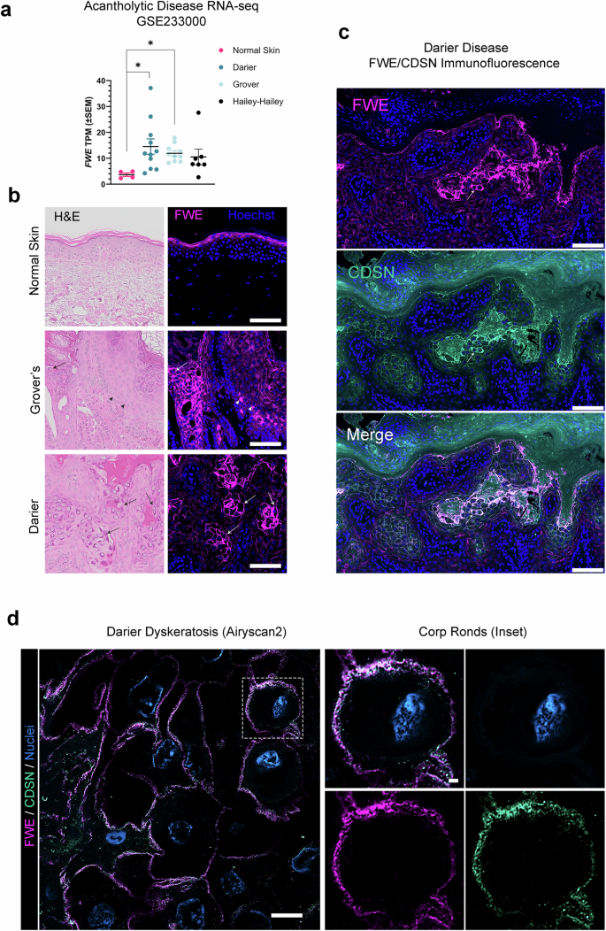 Fig. 7: Dysregulation of FWE-associated LBs characterizes epidermal pathologies driven by impaired cytosolic Ca2+ handling.