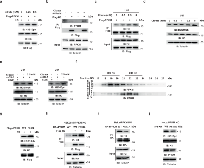 Fig. 4: Increased citrate levels enhance PFKM-dependent histone H3 phosphorylation.