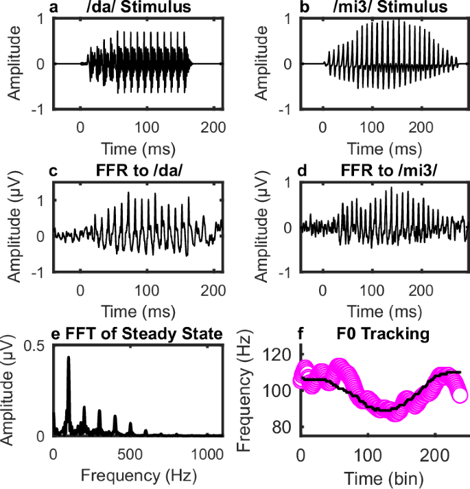 Fig. 1: Stimuli and sample neural responses.