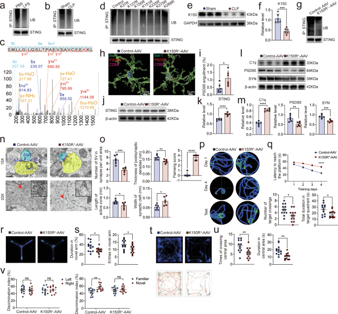 Fig. 4: The K150 site is crucial for STING ubiquitination in microglia.