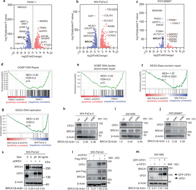 Fig. 3: Depletion of OFD1 downregulates BRCA1 expression.