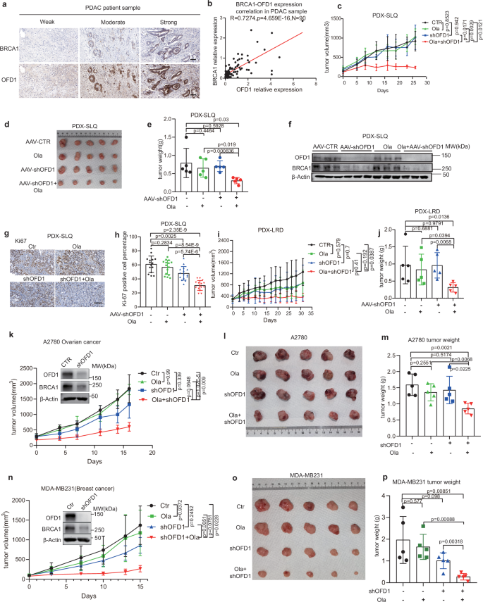 Fig. 8: The combination of OFD1 knockdown and PARP inhibition effectively suppresses tumor growth in PDAC PDX and other BRCA- associated cancer xenografts.