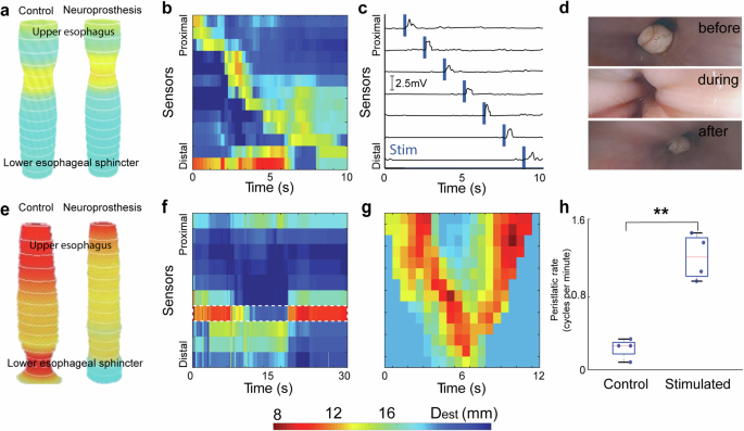 Fig. 5: Neuroprosthetic generation of peristalsis.