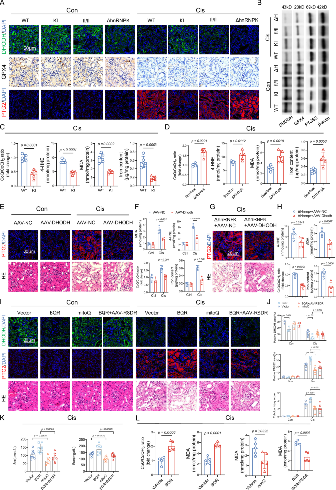 Fig. 7: RSDR and hnRNPK Co-regulate DHODH to Modulate Ferroptosis in AKI.