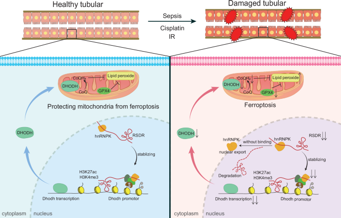 Fig. 9: Schematic illustrating the regulatory role of RSDR in ferroptosis during AKI.