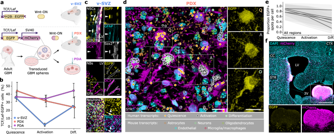 Fig. 5: Dysregulation of Wnt activity at the Q–A transition in GBM.