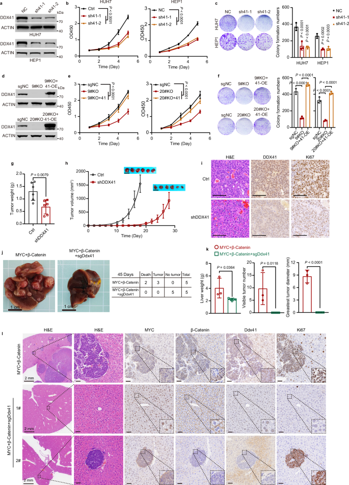 Fig. 2: DDX41 promotes liver cancer cell proliferation and is essential for liver cancer initiation.